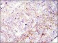 FAK Antibody